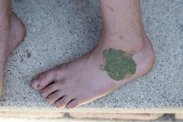 green paste on foot
